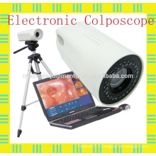 Colposcope portable pour ordinateur portable pour diagnostic / chirurgie gynécologique / vaginale et utérine